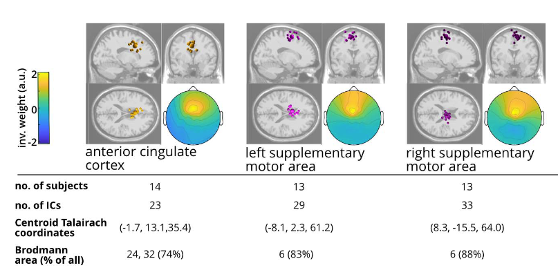 Mobile Brain Body Imaging (MoBI)