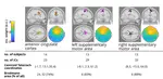 Differential Theta-Band Signatures of the Anterior Cingulate and Motor Cortices During Seated Locomotor Perturbations